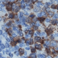 DOK2 Antibody - Immunohistochemical analysis of DOK2 staining in human lymph node formalin fixed paraffin embedded tissue section. The section was pre-treated using heat mediated antigen retrieval with sodium citrate buffer (pH 6.0). The section was then incubated with the antibody at room temperature and detected using an HRP polymer system. DAB was used as the chromogen. The section was then counterstained with hematoxylin and mounted with DPX.