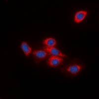 DOK2 Antibody - Immunofluorescent analysis of DOK2 staining in HeLa cells. Formalin-fixed cells were permeabilized with 0.1% Triton X-100 in TBS for 5-10 minutes and blocked with 3% BSA-PBS for 30 minutes at room temperature. Cells were probed with the primary antibody in 3% BSA-PBS and incubated overnight at 4 deg C in a humidified chamber. Cells were washed with PBST and incubated with a DyLight 594-conjugated secondary antibody (red) in PBS at room temperature in the dark. DAPI was used to stain the cell nuclei (blue).