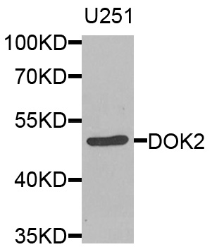 DOK2 Antibody - Western blot analysis of extracts of U251 cells.
