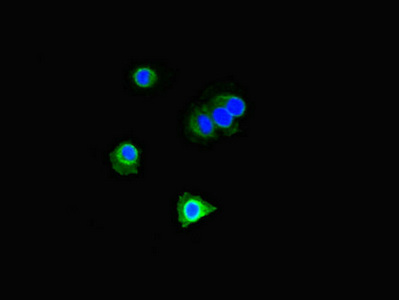 DOK2 Antibody - Immunofluorescent analysis of HeLa cells diluted at 1:100 and Alexa Fluor 488-congugated AffiniPure Goat Anti-Rabbit IgG(H+L)
