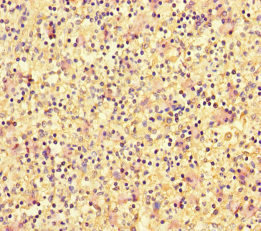 DOK2 Antibody - Immunohistochemistry of paraffin-embedded human spleen tissue at dilution of 1:100