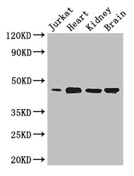 DOK2 Antibody - Western Blot Positive WB detected in:Jurkat whole cell lysate,Mouse heart tissue,Mouse kidney tissue,Mouse brain tissue All Lanes: DOK2 antibody at 3.4ug/ml Secondary Goat polyclonal to rabbit IgG at 1/50000 dilution Predicted band size: 46 kDa Observed band size: 46 kDa