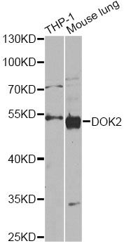 DOK2 Antibody - Western blot analysis of extracts of various cell lines, using DOK2 antibody at 1:1000 dilution. The secondary antibody used was an HRP Goat Anti-Rabbit IgG (H+L) at 1:10000 dilution. Lysates were loaded 25ug per lane and 3% nonfat dry milk in TBST was used for blocking. An ECL Kit was used for detection and the exposure time was 30s.