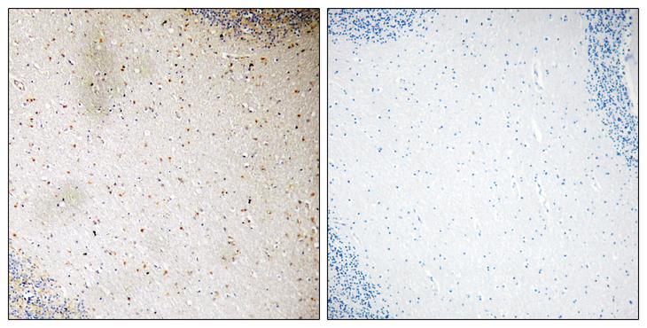 DOK2 Antibody - Peptide - + Immunohistochemistry analysis of paraffin-embedded human brain tissue using p56 Dok-2(Ab-345) antibody.