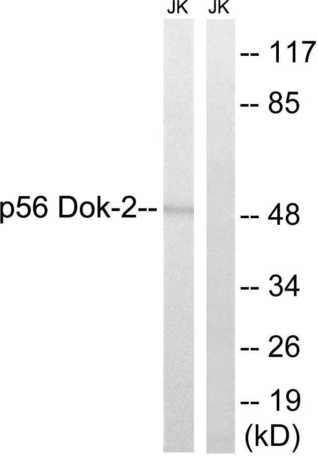 DOK2 Antibody - Western blot analysis of extracts from Jurkat cells, using p56 Dok-2(Ab-345) antibody.