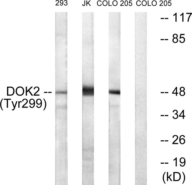 DOK2 Antibody - Western blot analysis of lysates from COS7 cells treated with insulin 0.01U/ml 15', Jurkat cells treated with insulin 0.01U/ml 15' and 293 cells treated with serum 20% 15', using p56 Dok-2 (Phospho-Tyr299) Antibody. The lane on the right is blocked with the phospho peptide.