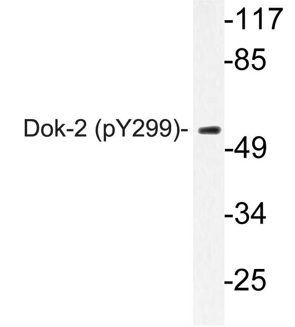 DOK2 Antibody - Western blot of p-Dok-2 (Y299) pAb in extracts from 293 serum cells.