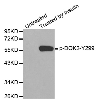 DOK2 Antibody - Western blot analysis of extracts from Jurkat cells.