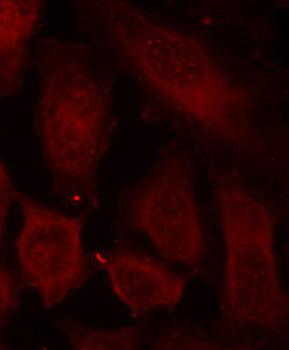 DOK2 Antibody - Immunofluorescence staining of methanol-fixed Hela cells.