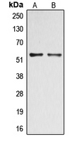 DOK2 Antibody - Western blot analysis of DOK2 (pY299) expression in A549 Insulin-treated (A); HepG2 (B) whole cell lysates.