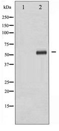 DOK2 Antibody - Western blot of p56 Dok-2 phosphorylation expression in K562 whole cell lysates,The lane on the left is treated with the antigen-specific peptide.