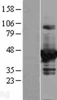 DOK2 Protein - Western validation with an anti-DDK antibody * L: Control HEK293 lysate R: Over-expression lysate