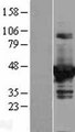 DOK2 Protein - Western validation with an anti-DDK antibody * L: Control HEK293 lysate R: Over-expression lysate