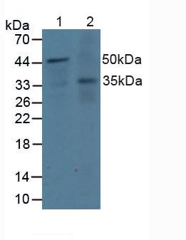 DOK3 Antibody - Western Blot; Sample: Lane1: Human Jurkat Cells; Lane2: Human A431 Cells.