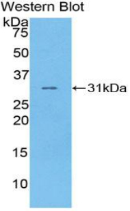 DOK3 Antibody - Western blot of recombinant DOK3.  This image was taken for the unconjugated form of this product. Other forms have not been tested.