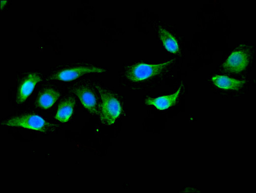 DOK3 Antibody - Immunofluorescent analysis of A549 cells using DOK3 Antibody at a dilution of 1:100 and Alexa Fluor 488-congugated AffiniPure Goat Anti-Rabbit IgG(H+L)