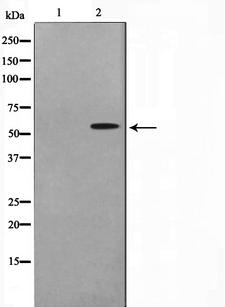DOK3 Antibody - Western blot analysis on HepG2 cell lysates using DOK3 antibody. The lane on the left is treated with the antigen-specific peptide.