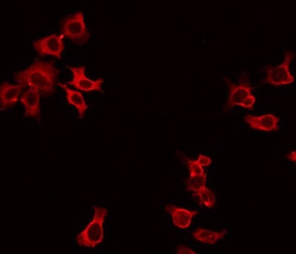 DOK3 Antibody - Staining HepG2 cells by IF/ICC. The samples were fixed with PFA and permeabilized in 0.1% Triton X-100, then blocked in 10% serum for 45 min at 25°C. The primary antibody was diluted at 1:200 and incubated with the sample for 1 hour at 37°C. An Alexa Fluor 594 conjugated goat anti-rabbit IgG (H+L) Ab, diluted at 1/600, was used as the secondary antibody.