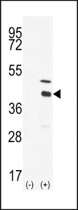 DOK4 Antibody - Western blot of DOK4 (arrow) using DOK4 Antibody. 293 cell lysates (2 ug/lane) either nontransfected (Lane 1) or transiently transfected with the DOK4 gene (Lane 2) (Origene Technologies).