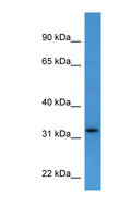 DOK4 Antibody - DOK4 antibody Western blot of Fetal Heart lysate.  This image was taken for the unconjugated form of this product. Other forms have not been tested.