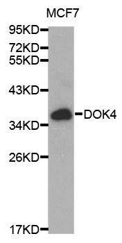 DOK4 Antibody - Western blot analysis of extracts of MCF-7 cells, using DOK4 antibody at 1:1000 dilution. The secondary antibody used was an HRP Goat Anti-Rabbit IgG (H+L) at 1:10000 dilution. Lysates were loaded 25ug per lane and 3% nonfat dry milk in TBST was used for blocking.