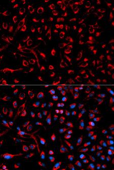 DOK4 Antibody - Immunofluorescence analysis of HeLa cells using DOK4 antibody. Blue: DAPI for nuclear staining.