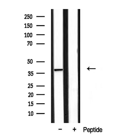 DOK4 Antibody - Western blot analysis of extracts of mouse muscle using DOK4 antibody.