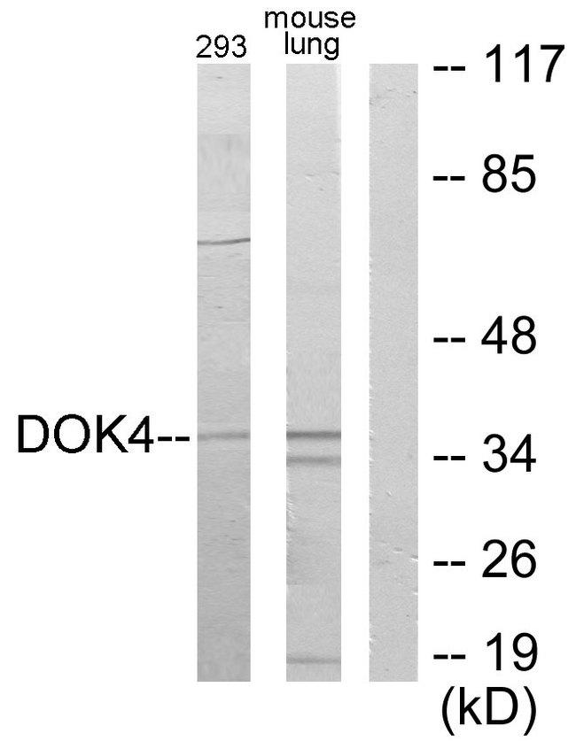 DOK4 Antibody - Western blot analysis of extracts from 293 cells and mouse lung cells, using DOK4 antibody.