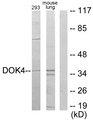 DOK4 Antibody - Western blot analysis of extracts from 293 cells and mouse lung cells, using DOK4 antibody.