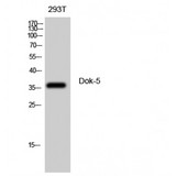 DOK5 Antibody - Western blot of Dok-5 antibody