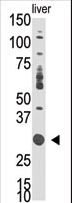 DOK5 Antibody - Western blot of anti-DOK5 antibody in mouse liver tissue lysate. DOK5(arrow) was detected using the purified Pab