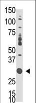 DOK5 Antibody - The anti-DOK5 C-term antibody is used in Western blot to detect DOK5 in mouse liver tissue lysate.