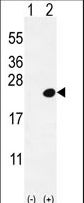 DOK5 Antibody - Western blot of DOK5 (arrow) using rabbit polyclonal DOK5 Antibody (L291). 293 cell lysates (2 ug/lane) either nontransfected (Lane 1) or transiently transfected (Lane 2) with the DOK5 gene.