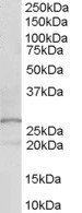 DOK5 Antibody - Antibody (0.1 ug/ml) staining of human kidney lysate (35 ug protein in RIPA buffer). Primary incubation was 1 hour. Detected by chemiluminescence.