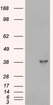 DOK5 Antibody - HEK293 overexpressing DOK5 (RC211718) and probed with (mock transfection in first lane).