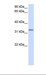 DOK5 Antibody - Placenta lysate. Antibody concentration: 1.0 ug/ml. Gel concentration: 12%.  This image was taken for the unconjugated form of this product. Other forms have not been tested.
