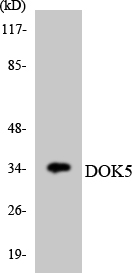 DOK5 Antibody - Western blot analysis of the lysates from HT-29 cells using DOK5 antibody.