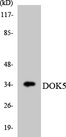DOK5 Antibody - Western blot analysis of the lysates from HT-29 cells using DOK5 antibody.