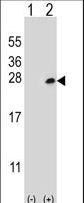 DOK5 Antibody - Western blot of Dok5 (arrow) using rabbit polyclonal Dok5 Antibody (PTB domain). 293 cell lysates (2 ug/lane) either nontransfected (Lane 1) or transiently transfected (Lane 2) with the Dok5 gene.
