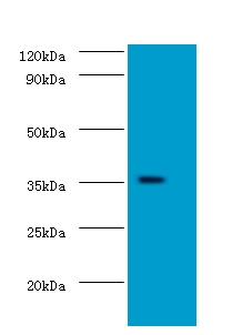 DOK5 Antibody - Western blot of Docking protein 5 antibody at 2 ug/ml with mouse kidney tissue Secondary Goat polyclonal to Rabbit IgG at 1:15000 dilution. Predicted band size: 35 KDa. Observed band size: 35 KDa.  This image was taken for the unconjugated form of this product. Other forms have not been tested.