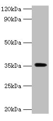 DOK5 Antibody - Western blot All lanes: Docking protein 5 antibody at 2µg/ml + Mouse kidney tissue Secondary Goat polyclonal to rabbit IgG at 1/15000 dilution Predicted band size: 36, 23 kDa Observed band size: 36 kDa