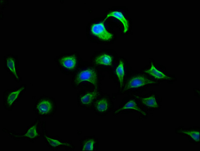 DOK5 Antibody - Immunofluorescence staining of A549 cells with DOK5 Antibody at 1:133, counter-stained with DAPI. The cells were fixed in 4% formaldehyde, permeabilized using 0.2% Triton X-100 and blocked in 10% normal Goat Serum. The cells were then incubated with the antibody overnight at 4°C. The secondary antibody was Alexa Fluor 488-congugated AffiniPure Goat Anti-Rabbit IgG(H+L).