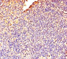 DOK5 Antibody - Immunohistochemistry of paraffin-embedded human tonsil tissue using DOK5 Antibody at dilution of 1:100