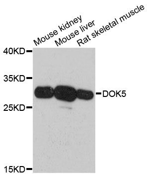 DOK5 Antibody - Western blot analysis of extracts of various cell lines, using DOK5 antibody at 1:3000 dilution. The secondary antibody used was an HRP Goat Anti-Rabbit IgG (H+L) at 1:10000 dilution. Lysates were loaded 25ug per lane and 3% nonfat dry milk in TBST was used for blocking. An ECL Kit was used for detection and the exposure time was 30s.