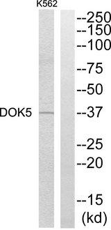 DOK5 Antibody - Western blot analysis of extracts from K562 cells, using DOK5 antibody.