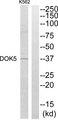 DOK5 Antibody - Western blot analysis of extracts from K562 cells, using DOK5 antibody.