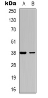 DOK6 Antibody - Western blot analysis of DOK6 expression in SHSY5Y (A); COLO205 (B) whole cell lysates.
