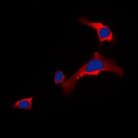 DOK6 Antibody - Immunofluorescent analysis of DOK6 staining in COLO205 cells. Formalin-fixed cells were permeabilized with 0.1% Triton X-100 in TBS for 5-10 minutes and blocked with 3% BSA-PBS for 30 minutes at room temperature. Cells were probed with the primary antibody in 3% BSA-PBS and incubated overnight at 4 deg C in a humidified chamber. Cells were washed with PBST and incubated with a DyLight 594-conjugated secondary antibody (red) in PBS at room temperature in the dark. DAPI was used to stain the cell nuclei (blue).