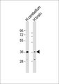 DOK6 Antibody - All lanes: Anti-DOK6 Antibody at 1:500-1:1000 dilution. Lane 1: human cerebellum lysate. Lane 2: human brain lysate Lysates/proteins at 20 ug per lane. Secondary Goat Anti-Rabbit IgG, (H+L), Peroxidase conjugated at 1:10000 dilution. Predicted band size: 38 kDa. Blocking/Dilution buffer: 5% NFDM/TBST.