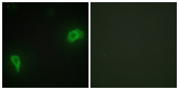 DOK7 Antibody - Immunofluorescence analysis of HepG2 cells, using DOK7 Antibody. The picture on the right is blocked with the synthesized peptide.